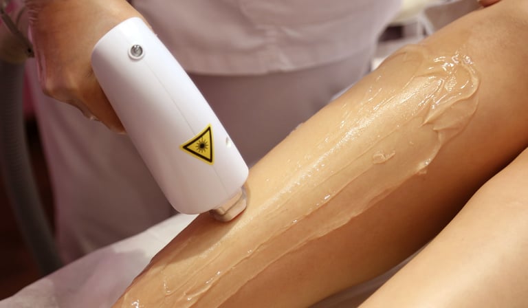 12 Must-Try Laser Hair Removal Types: Exploring Your Options