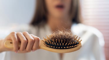 An Essential Guide To Preventing Female Hair Loss