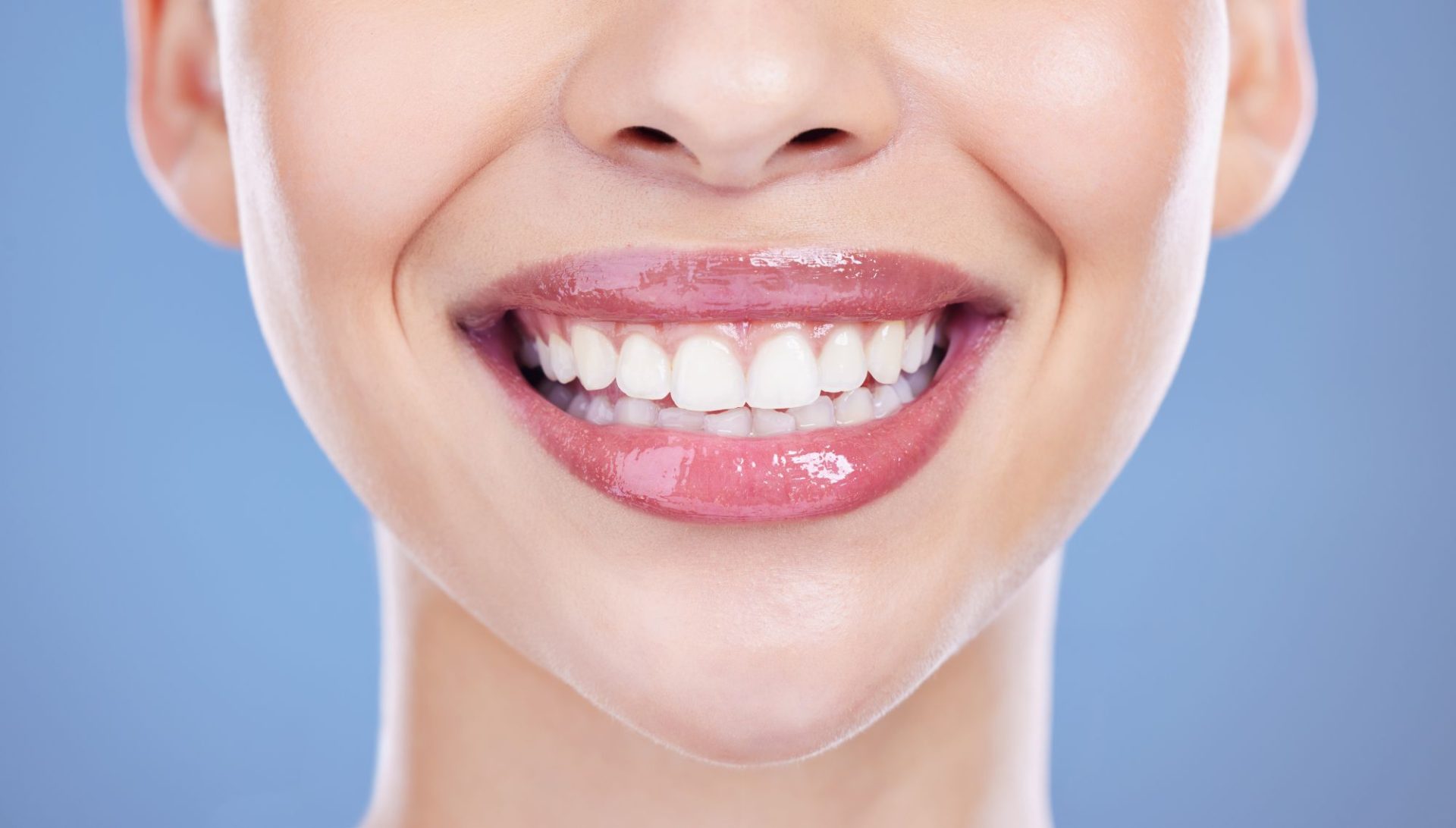 Common Mistakes People Make When Getting Clear Aligners