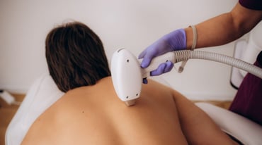 Inside Cryotherapy for Skin Lesion Removal