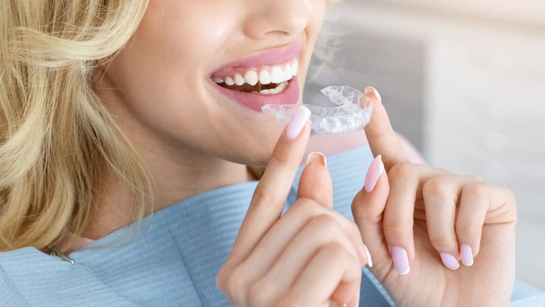 What to Expect with Aligners - Complete Guide